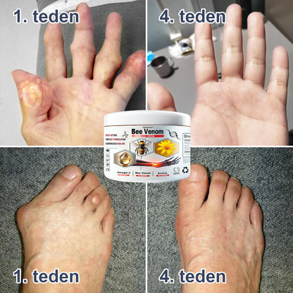 🌈🌈𝐓𝐎𝐃𝐀𝐇𝐎𝐅™ Krema za lajšanje bolečin in celjenje kosti s čebeljim strupom🔥Primerno za vse starosti💎 Časovno omejeno 60 % popusta💎
