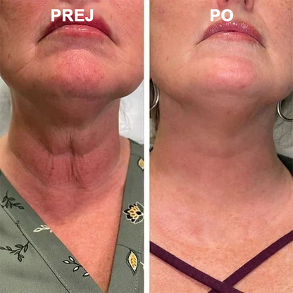 🌿𝐅𝐮𝐛𝐬𝐭𝐚® pomlajevalno olje za učvrstitev kože🩵 Zadnji dan popusta: 75 % CENEJE💧