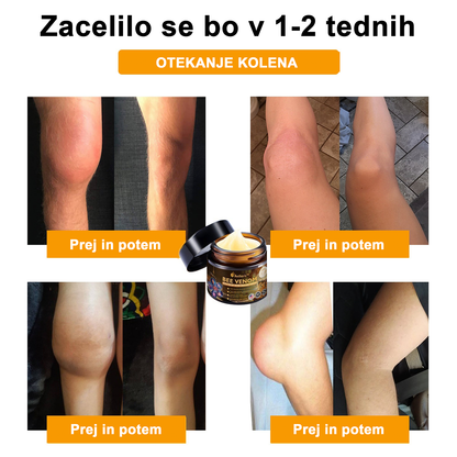 🔥 𝘈𝘦𝘵𝘩𝘦𝘳𝘪𝘴™ Krema za lajšanje artritisa s čebeljim strupom (posebej za starejše odrasle) 🦴– zadnji dan promocije: 70 % popusta 💪