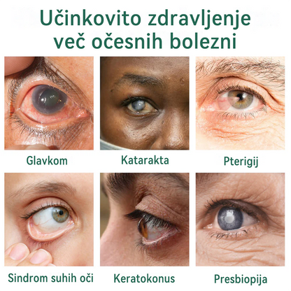 👩‍⚕️Ourlyard® Nano kapljice za oči ✅Odobreno s strani EMA (primerno za daljnovidnost, sindrom suhega očesa, glavkom in sivo mreno) ☘️