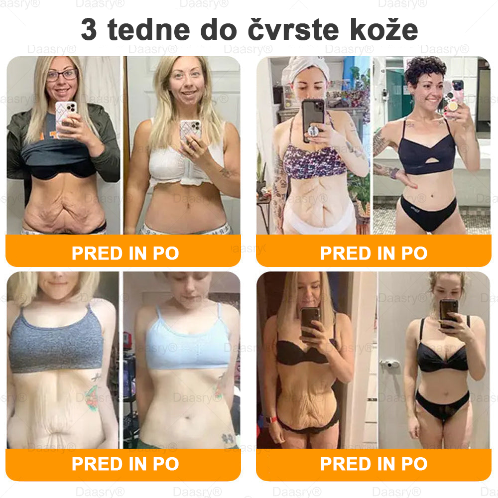 Daasry® Krema z čebeljim strupom vsebuje peptide čebeljega strupa, botulin toksin, hialuronsko kislino in kolagen✨ Za gubice, drobne linije, ohlapno kožo, strije in temne madeže! 💖 Pusti, da tvoja koža postane bolj čvrsta, napeta in sijoča! ✨