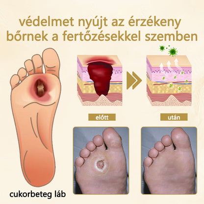 Cvreoz® čebelji strup v zdravilnem pršilu za celjenje in obnovo ran na rokah in nogah ⭐️