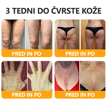 VLSVLS® krema za obnovo kože s čebeljim strupom 🔥 ZADNJI DAN 80% CENEJE 🐝🐝