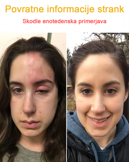🐝✨𝑩𝑺𝑾𝑬𝑳𝑳® Krema za nego kože z čebeljim strupom👨‍⚕️ (Priporočena s strani AAD) (🔥 Zadnji dan promocije, prihranite 70%)
