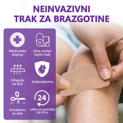 🏷️ Uradna Trgovina: flysmus® ReGen Mikronadlaste Ploščice z Nano-Hialuronsko Kislino (Nano-Heal) 💝 Zdravljenje novih in starih brazgotin, zmanjševanje kirurških brazgotin, strij, keloidov, aken, opeklin, bradavic, dermatomov in krčnih žil