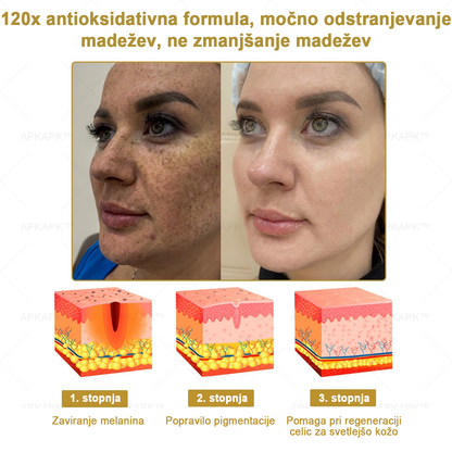 𝐀𝐏𝐊𝐀𝐏𝐊™ Zelo učinkovita večnamenska vlažilna krema za odstranjevanje bradavic