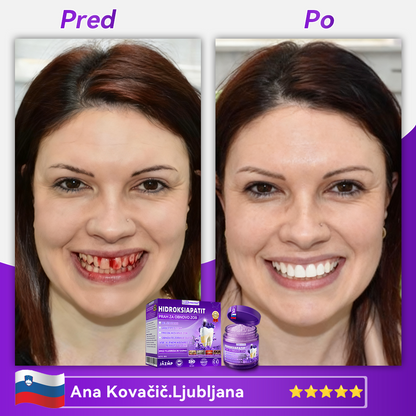 Uradna trgovina 🌌| 𝐷𝑜𝑟𝑚𝑜𝑟𝑛𝑎® 𝐻𝑖𝑑𝑟𝑜𝑘𝑠𝑖𝑎𝑝𝑎𝑡𝑖𝑡 𝑃𝑟𝑎ℎ 𝑧𝑎 𝑜𝑏𝑛𝑜𝑣𝑜 𝑧𝑜𝑏