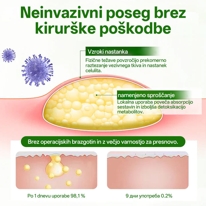 Cvreoz® KnotAway Pomirjevalno Mazilo – Pomirjevalno Mazilo za Naravno Zmanjšanje Lipomov🌿