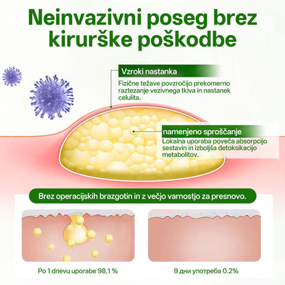 Cvreoz® KnotAway Pomirjevalno Mazilo – Pomirjevalno Mazilo za Naravno Zmanjšanje Lipomov🌿