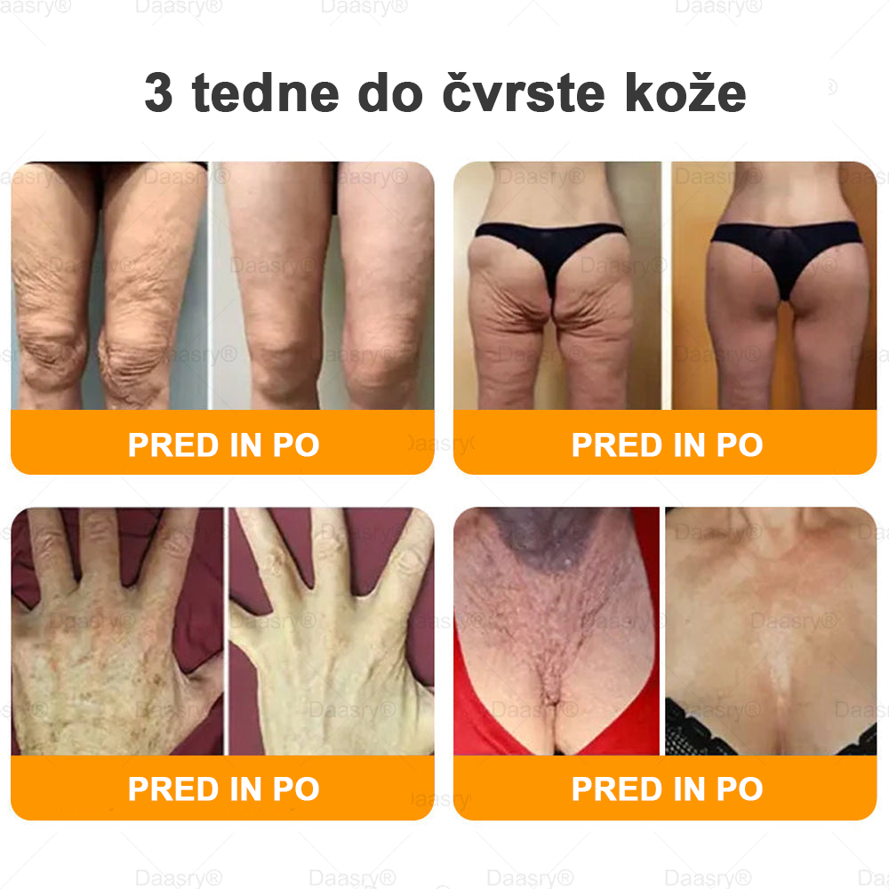 Daasry® Krema z čebeljim strupom vsebuje peptide čebeljega strupa, botulin toksin, hialuronsko kislino in kolagen✨ Za gubice, drobne linije, ohlapno kožo, strije in temne madeže! 💖 Pusti, da tvoja koža postane bolj čvrsta, napeta in sijoča! ✨
