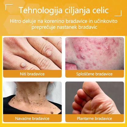 🐝Twinsun™ Izjemno Močna Krema z Čebeljim Strupom, s certifikatom EMA💖 Za zdravljenje bradavic, kožnih izrastkov, okužb in keratoze, ter za glajenje neenakomerne kože