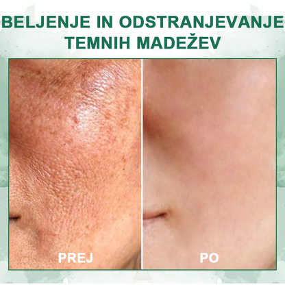 🌿Osvežite kožo v samo treh dneh💝𝙁𝙪𝙗𝙨𝙩𝙖™ pomlajevalni in učvrstitveni serum🔥