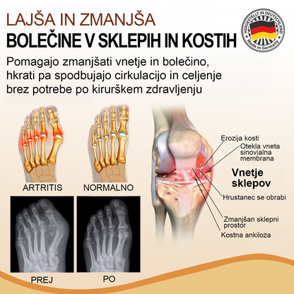 🌿TODAHOF™ Sprej za sklepe s čebeljim strupom💎Primeren za vse starosti🔥 Časovno omejen 75% popust