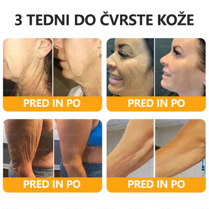 VLSVLS® krema za obnovo kože s čebeljim strupom 🔥 ZADNJI DAN 80% CENEJE 🐝🐝