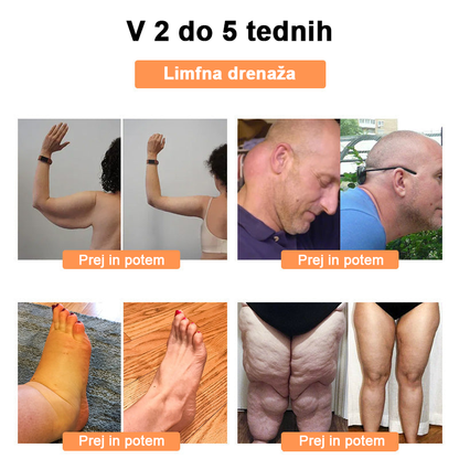 🍀🎈𝐅𝐑𝐎𝐏𝐔𝐍™ Čebelji strup Limfna drenaža obliž za hujšanje (Za vse limfatične težave in debelost)