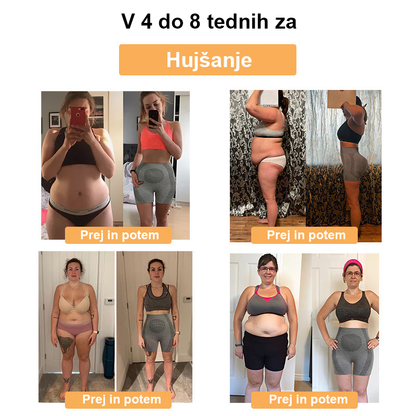 ✨【Pripravljeno na jesen 2025】𝐒𝐡𝐨𝐫𝐭𝐬™ mikrovibracijski masažni modul, popravilo ionskih vlaken, kratke hlače za oblikovanje🌻