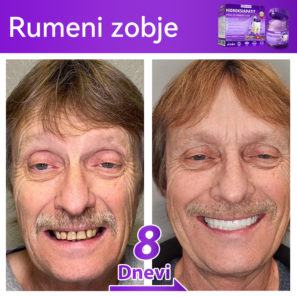 Uradna trgovina 🌌| 𝐷𝑜𝑟𝑚𝑜𝑟𝑛𝑎® 𝐻𝑖𝑑𝑟𝑜𝑘𝑠𝑖𝑎𝑝𝑎𝑡𝑖𝑡 𝑃𝑟𝑎ℎ 𝑧𝑎 𝑜𝑏𝑛𝑜𝑣𝑜 𝑧𝑜𝑏