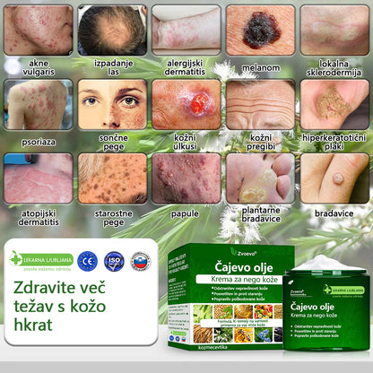 ✅ Certificirano s strani JAZMP 🌿 Zvoevo® Krema z oljem čajevca – Odpravlja nepravilnosti na koži, obnavlja poškodovano kožo, posvetli polt in nudi nego proti staranju 🌳