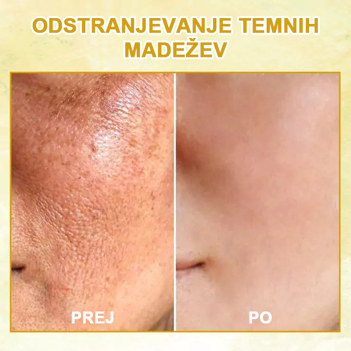 🌿𝐅𝐮𝐛𝐬𝐭𝐚® pomlajevalno olje za učvrstitev kože🩵 Zadnji dan popusta: 75 % CENEJE💧