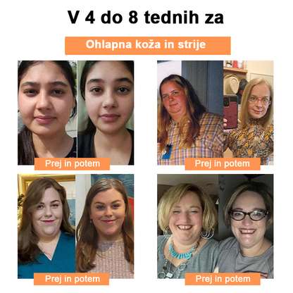 🍀🎈𝐅𝐑𝐎𝐏𝐔𝐍™ Čebelji strup Limfna drenaža obliž za hujšanje (Za vse limfatične težave in debelost)