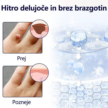 Timilk® WartErase kriogeno pršilo proti bradavicam ❄️