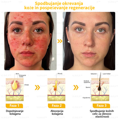 𝐕𝐋𝐒𝐕𝐋𝐒™ 𝐊𝐫𝐞𝐦𝐚 𝐳𝐚 𝐨𝐛𝐧𝐨𝐯𝐨 𝐤𝐨ž𝐞 𝐜𝐞𝐥𝐨𝐭𝐧𝐞𝐠𝐚 𝐭𝐞𝐥𝐞𝐬𝐚 – (🧑‍⚕️ Strokovno priporočilo 🤩 Dobitnik nagrade Readers' Choice Award 2024)