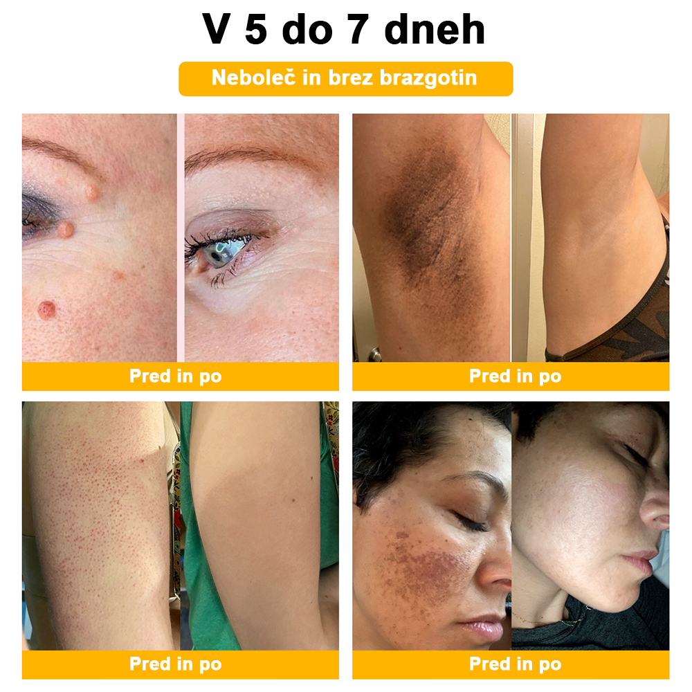 🍊𝑻𝒖𝒓𝒐𝒏𝒖™ Zdravilno mazilo s čebeljim strupom (👨‍⚕𝐀𝐀𝐃 PRIPOROČILA)