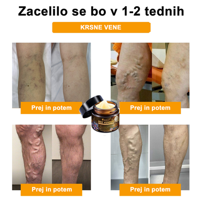 🔥 𝘈𝘦𝘵𝘩𝘦𝘳𝘪𝘴™ Krema za lajšanje artritisa s čebeljim strupom (posebej za starejše odrasle) 🦴– zadnji dan promocije: 70 % popusta 💪