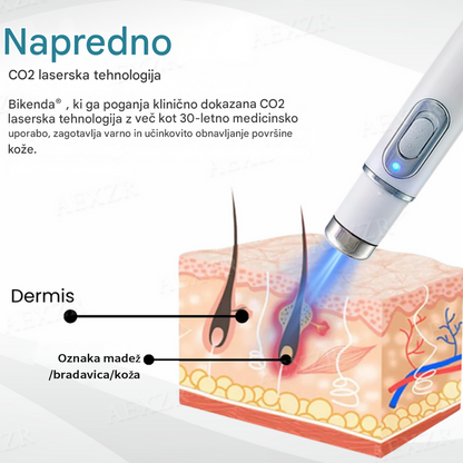Bikenda® neinvazivno lasersko pero za odstranjevanje madežev in bradavic