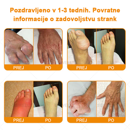 BSWELL™ Lidokain Gel za lajšanje bolečin- (zmanjšuje otekanje sklepov, bolečino, okorelost, rdečico, toploto, bolečino in utrujenost sklepov), 4% lidokain, glukozamin, MSM, arnika, hondroitin, vitamin K2.