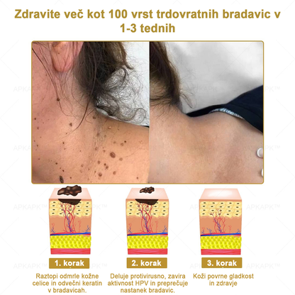 𝐀𝐏𝐊𝐀𝐏𝐊™ Zelo učinkovita večnamenska vlažilna krema za odstranjevanje bradavic