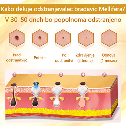 🌟 TOPWAL® Condense Krema za obnovo kože z čebeljim strupom 🌿 Spodbuja regeneracijo kože 💧 Globoko vlaži in neguje ✨ Zmanjšuje drobne gube in linije 🐝 Obogatena z naravnim čebeljim strupom ✔️ Primerna za vse tipe kože, tudi občutljivo
