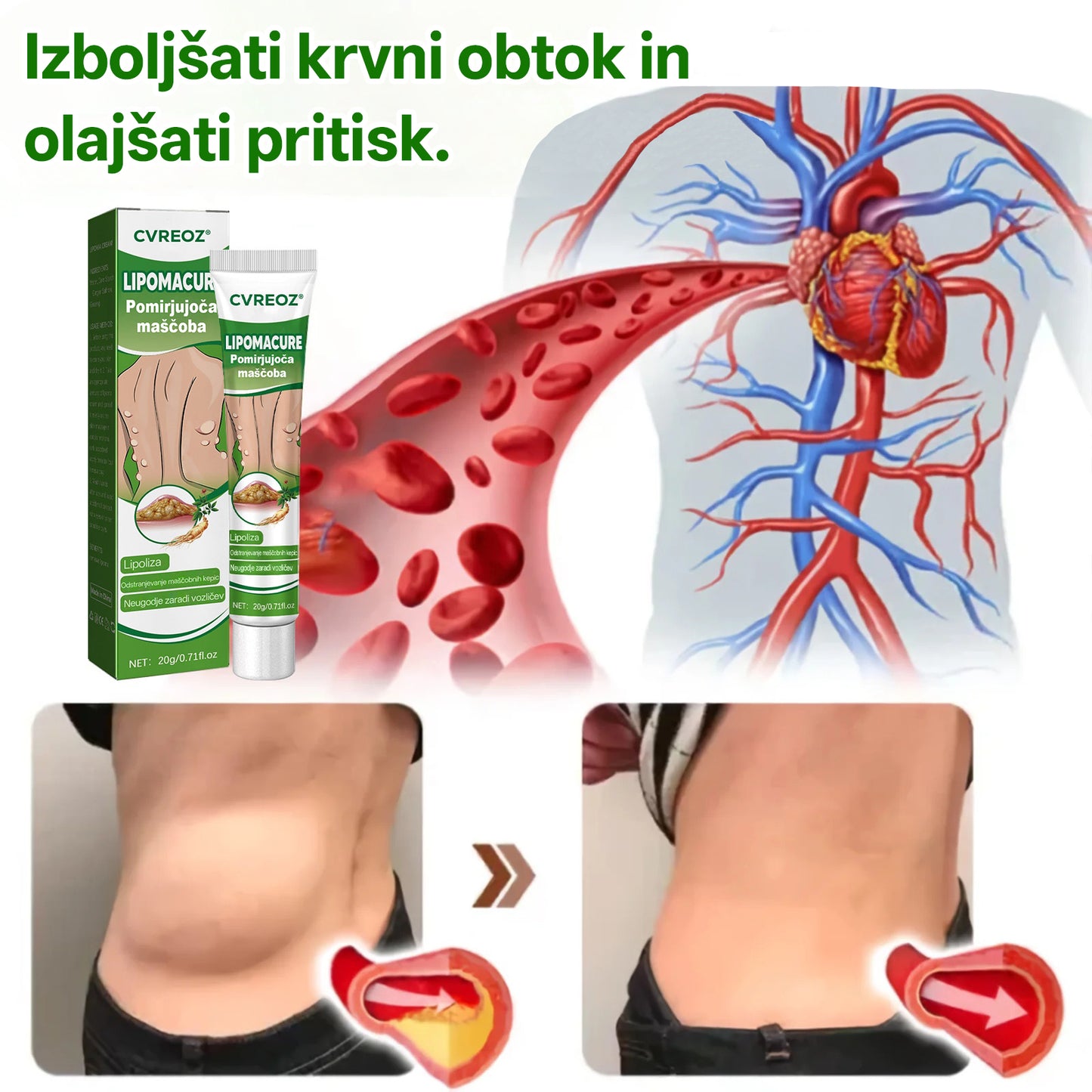 Cvreoz® KnotAway Pomirjevalno Mazilo – Pomirjevalno Mazilo za Naravno Zmanjšanje Lipomov🌿