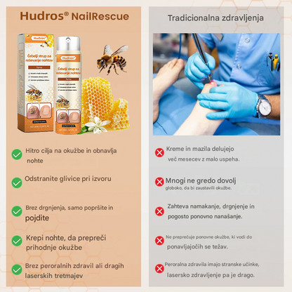 💥 2025 Omejeno 70 % CENEJE ️⏳ Ceoerty® NailRescue Kolirin pršilo proti glivicam s čebeljim strupom 💥 Vse težave z nohti lahko pozdravite v 2 tednih