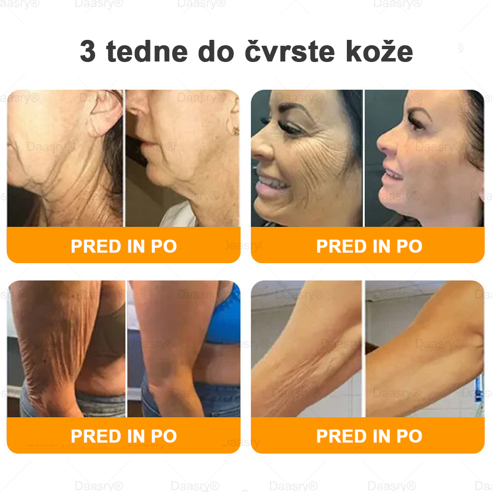 Daasry® Krema z čebeljim strupom vsebuje peptide čebeljega strupa, botulin toksin, hialuronsko kislino in kolagen✨ Za gubice, drobne linije, ohlapno kožo, strije in temne madeže! 💖 Pusti, da tvoja koža postane bolj čvrsta, napeta in sijoča! ✨