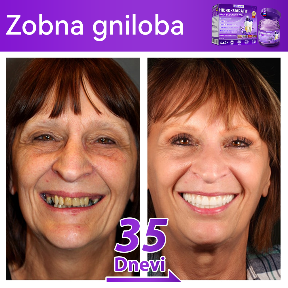 Uradna trgovina 🌌| 𝐷𝑜𝑟𝑚𝑜𝑟𝑛𝑎® 𝐻𝑖𝑑𝑟𝑜𝑘𝑠𝑖𝑎𝑝𝑎𝑡𝑖𝑡 𝑃𝑟𝑎ℎ 𝑧𝑎 𝑜𝑏𝑛𝑜𝑣𝑜 𝑧𝑜𝑏