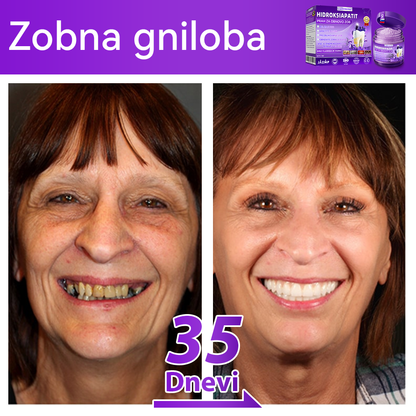 Uradna trgovina 🌌| 𝐷𝑜𝑟𝑚𝑜𝑟𝑛𝑎® 𝐻𝑖𝑑𝑟𝑜𝑘𝑠𝑖𝑎𝑝𝑎𝑡𝑖𝑡 𝑃𝑟𝑎ℎ 𝑧𝑎 𝑜𝑏𝑛𝑜𝑣𝑜 𝑧𝑜𝑏