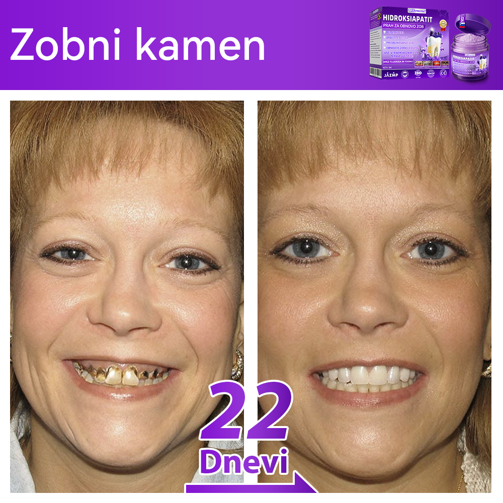 Uradna trgovina 🌌| 𝐷𝑜𝑟𝑚𝑜𝑟𝑛𝑎® 𝐻𝑖𝑑𝑟𝑜𝑘𝑠𝑖𝑎𝑝𝑎𝑡𝑖𝑡 𝑃𝑟𝑎ℎ 𝑧𝑎 𝑜𝑏𝑛𝑜𝑣𝑜 𝑧𝑜𝑏