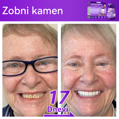 Uradna trgovina 🌌| 𝐷𝑜𝑟𝑚𝑜𝑟𝑛𝑎® 𝐻𝑖𝑑𝑟𝑜𝑘𝑠𝑖𝑎𝑝𝑎𝑡𝑖𝑡 𝑃𝑟𝑎ℎ 𝑧𝑎 𝑜𝑏𝑛𝑜𝑣𝑜 𝑧𝑜𝑏