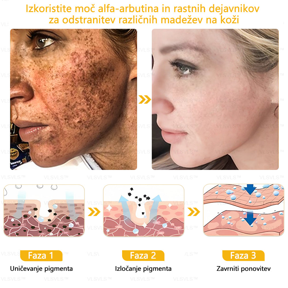 𝐕𝐋𝐒𝐕𝐋𝐒™ 𝐊𝐫𝐞𝐦𝐚 𝐳𝐚 𝐨𝐛𝐧𝐨𝐯𝐨 𝐤𝐨ž𝐞 𝐜𝐞𝐥𝐨𝐭𝐧𝐞𝐠𝐚 𝐭𝐞𝐥𝐞𝐬𝐚 – (🧑‍⚕️ Strokovno priporočilo 🤩 Dobitnik nagrade Readers' Choice Award 2024)