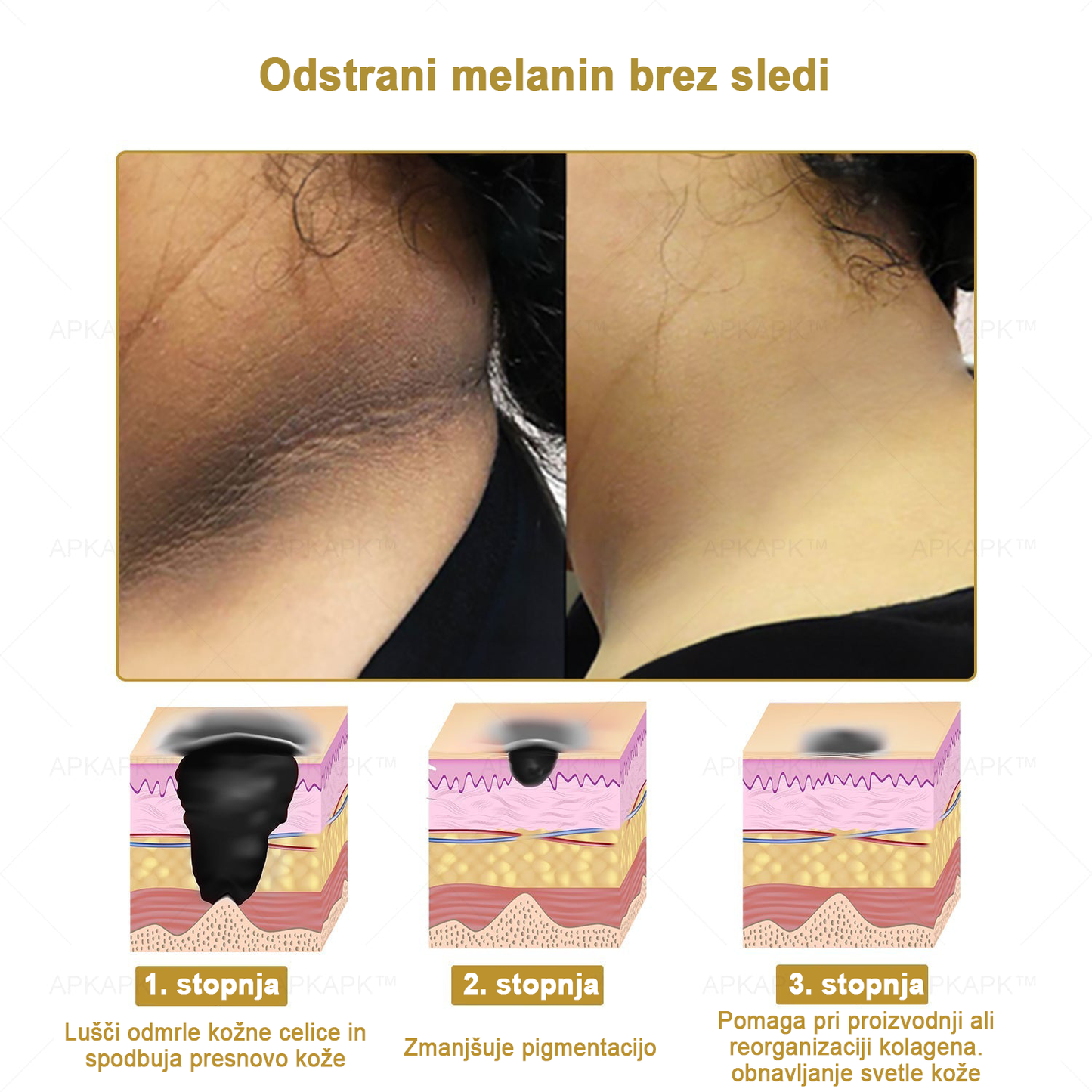 𝐀𝐏𝐊𝐀𝐏𝐊™ Zelo učinkovita večnamenska vlažilna krema za odstranjevanje bradavic