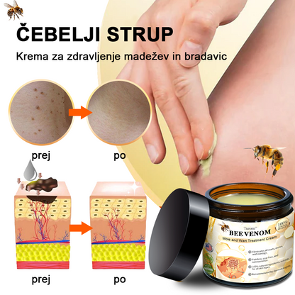 🍊𝑻𝒖𝒓𝒐𝒏𝒖™ Zdravilno mazilo s čebeljim strupom (👨‍⚕𝐀𝐀𝐃 PRIPOROČILA)