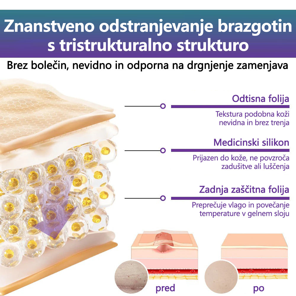 🏷️ Uradna Trgovina: flysmus® ReGen Mikronadlaste Ploščice z Nano-Hialuronsko Kislino (Nano-Heal) 💝 Zdravljenje novih in starih brazgotin, zmanjševanje kirurških brazgotin, strij, keloidov, aken, opeklin, bradavic, dermatomov in krčnih žil