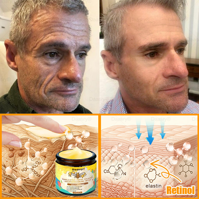Daasry® Krema z čebeljim strupom vsebuje peptide čebeljega strupa, botulin toksin, hialuronsko kislino in kolagen✨ Za gubice, drobne linije, ohlapno kožo, strije in temne madeže! 💖 Pusti, da tvoja koža postane bolj čvrsta, napeta in sijoča! ✨