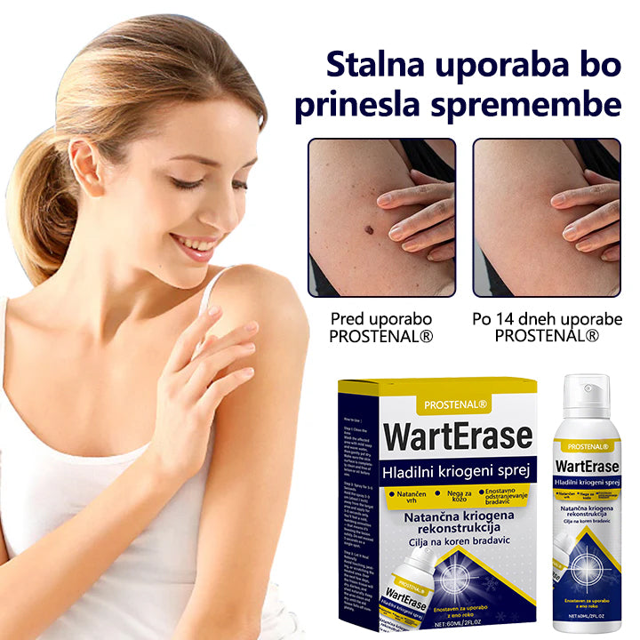 Timilk® WartErase kriogeno pršilo proti bradavicam ❄️