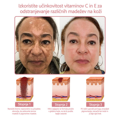 Koencim Q10 Collagen Jelly Skin Cream Odobreno Britansko združenje dermatologov (BAD) (pomaga pri aknah, bradavicah, rozacei, psoriazi, starostnih pegah, ekcemih in zmanjša videz strij)