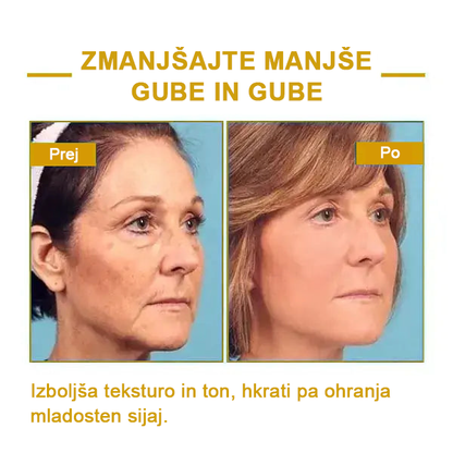 🌿𝐅𝐮𝐛𝐬𝐭𝐚® pomlajevalno olje za učvrstitev kože🩵 Zadnji dan popusta: 75 % CENEJE💧