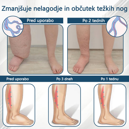 ATTDX® Črni kumen – zeliščna krema za pomiritev oteklin 🌿