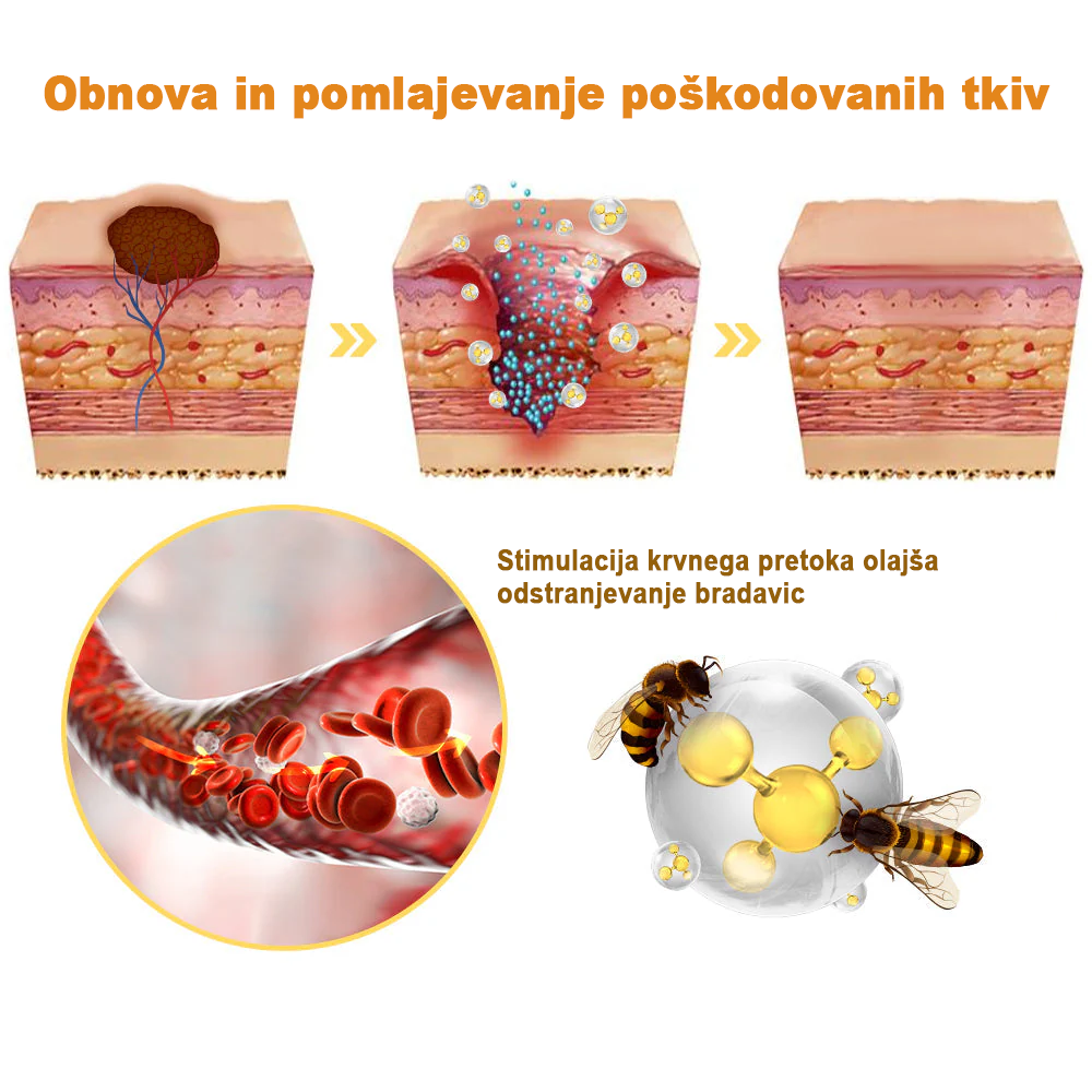 ✨𝐙𝐨𝐞𝐧𝐜𝐠𝐳™ krema s čebeljim strupom za znamenja in bradavice🔥