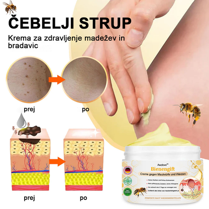 [🌟 gotovina ob dostavi (COD) 🌟] 𝐀𝐰𝐳𝐥𝐨𝐯𝐞™ Krema za zdravljenje madežev in bradavic s čebeljim strupom (priporočila 👨‍⚕AAD)